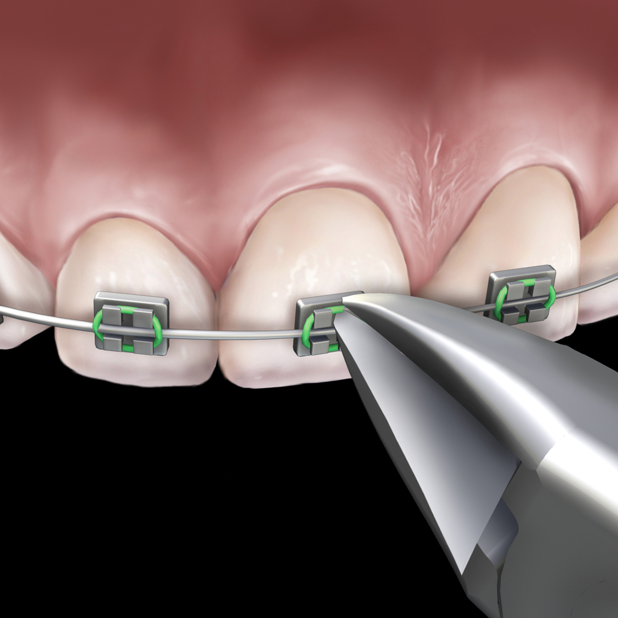 678-500__678-500-clinical-illustration_rgb