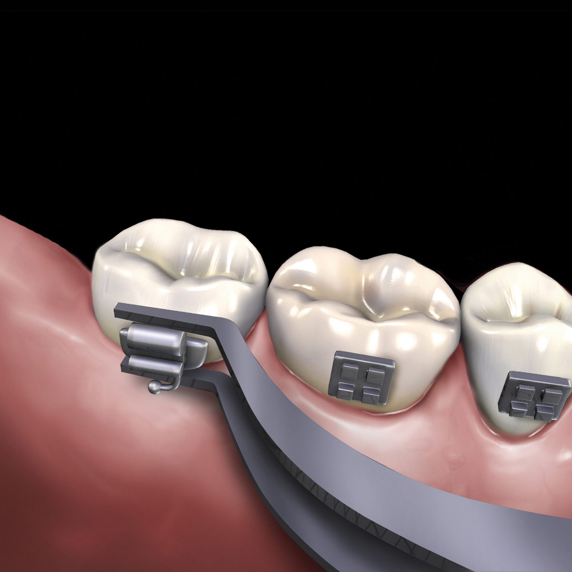 678-505__678-505-clinical-illustration_rgb
