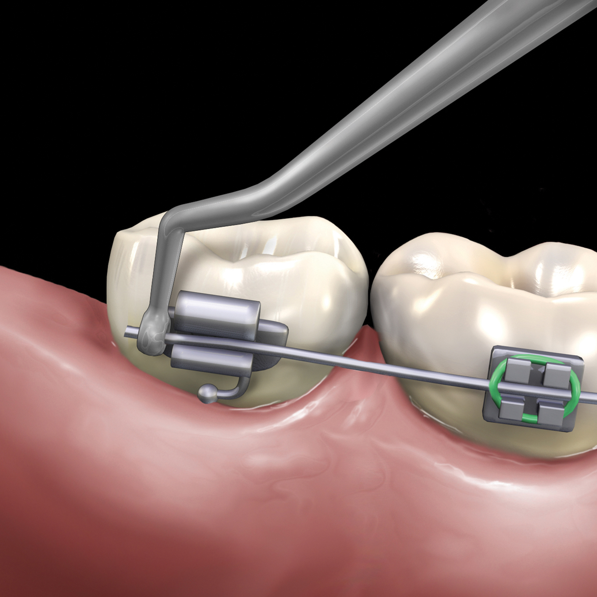 678-506__678-506-clinical-illustration_1_rgb