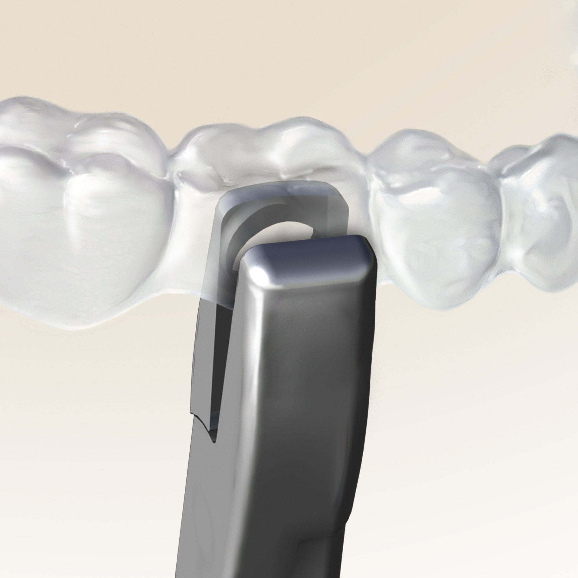 678-803__678-803_clinical_illustration_1_full_rgb