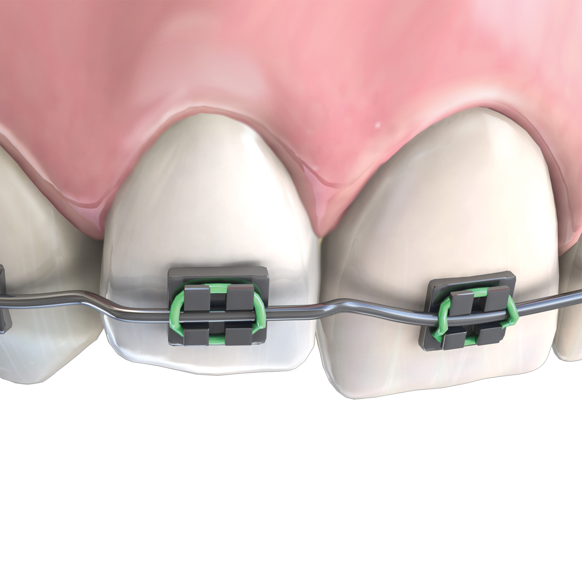 678-342__378-340_step_pliers_clinical_illustration_rgb_2