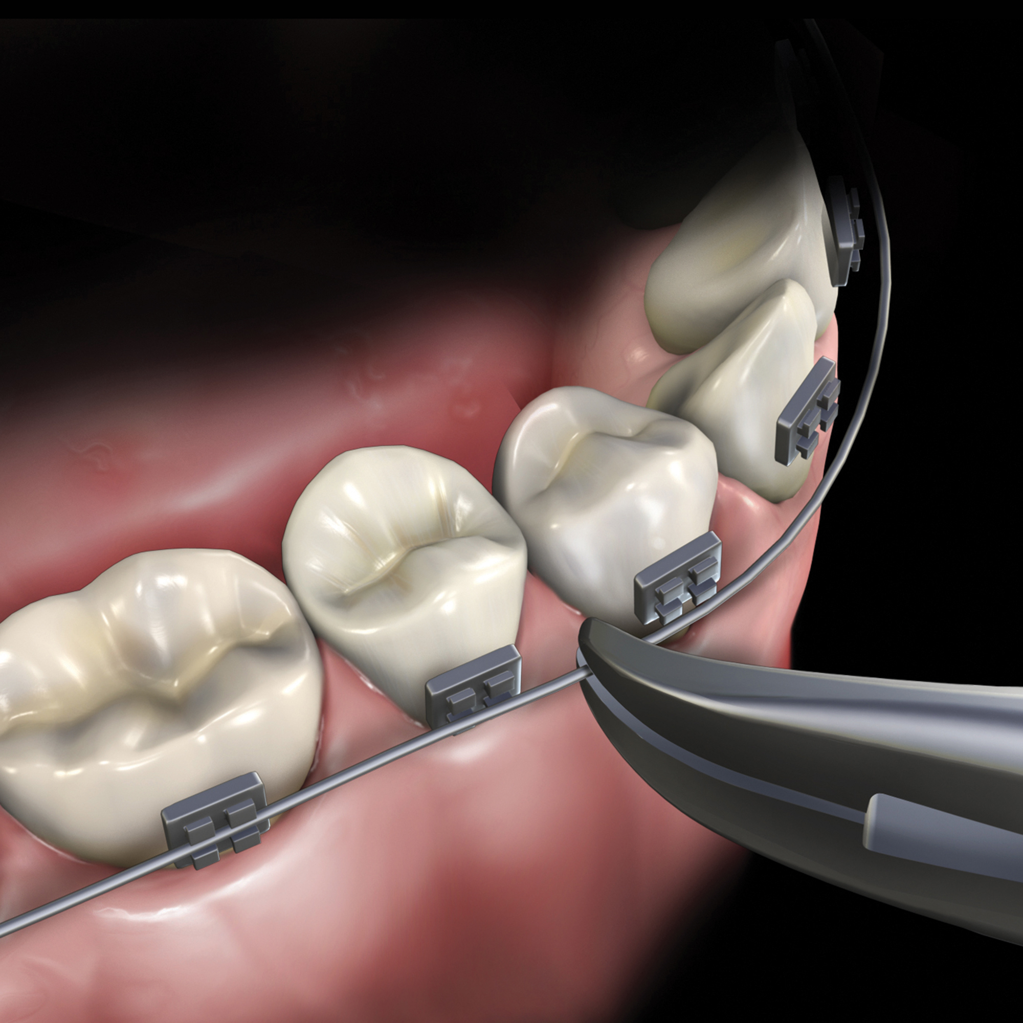 678-501__678-501-clinical-illustration_rgb
