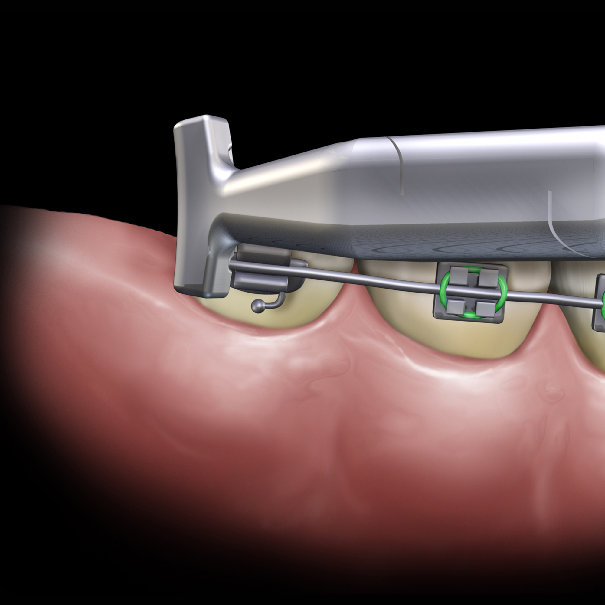 678-502__678-502-clinical-illustration_2_rgb