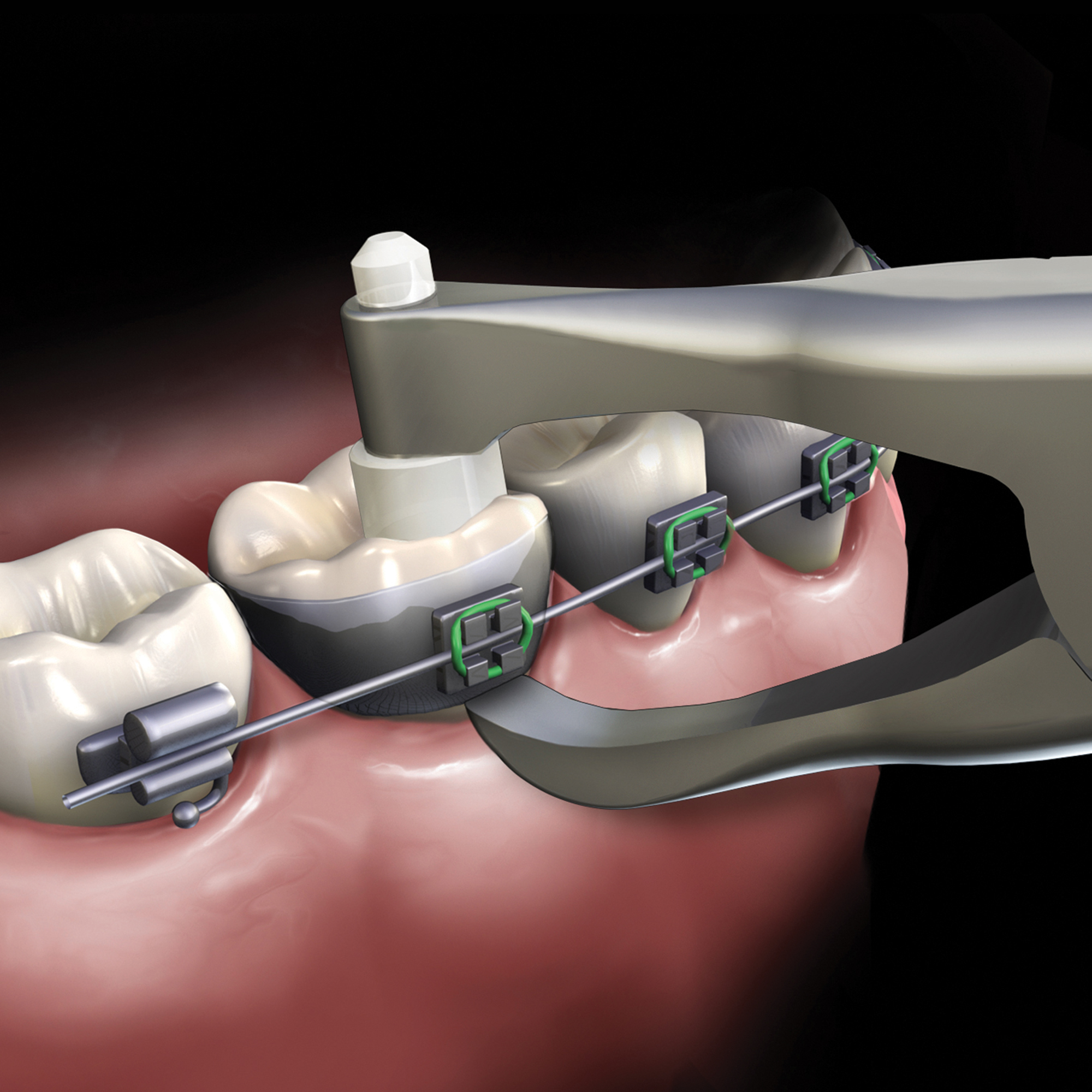 678-503__678-503-clinical-illustration_rgb