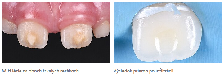 icon vestibul 2