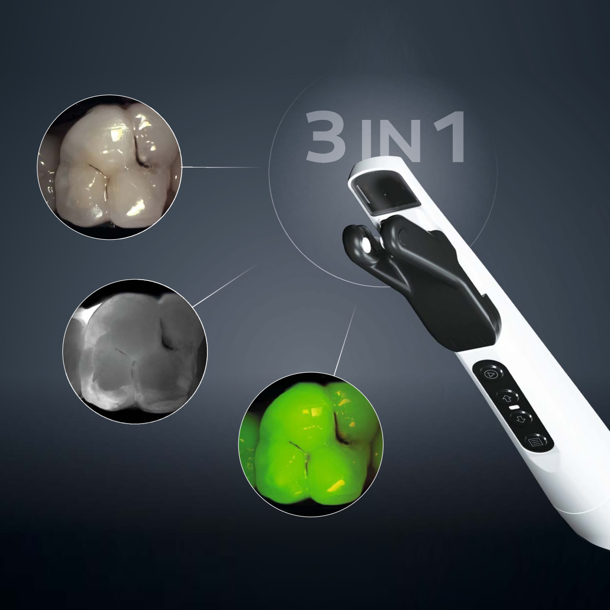 DIAGNOcam 1
